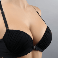 Breast Uplift in Antalya